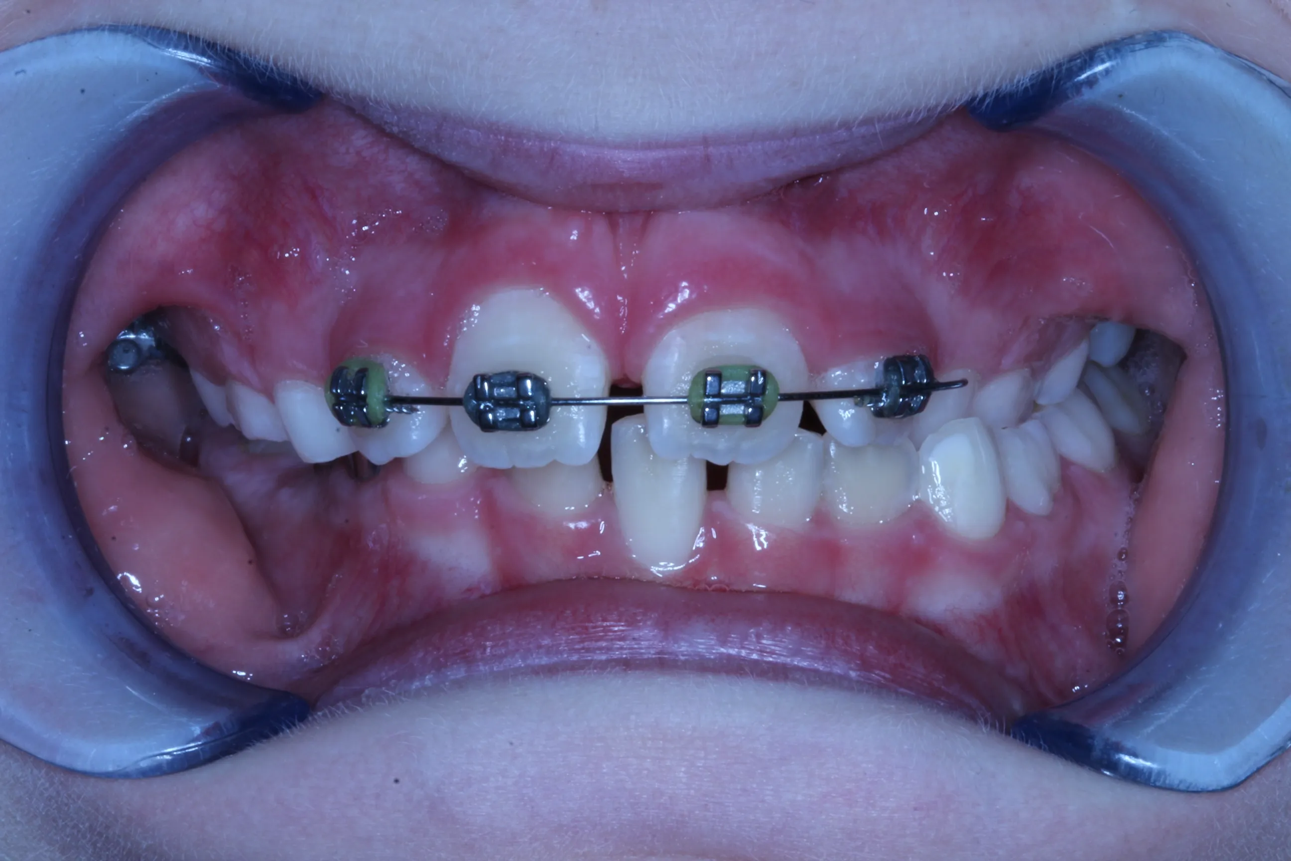 smile-gallery gallery